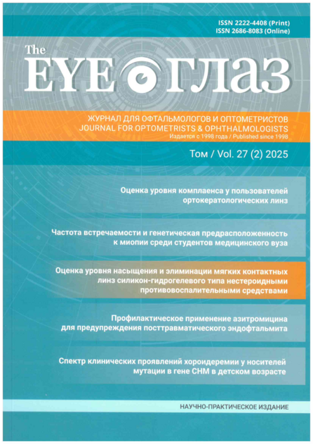The Eye Глаз